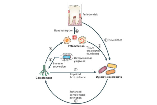 p periodonitis gingivalis y diabetes p periodonitis gingivalis y diabetes